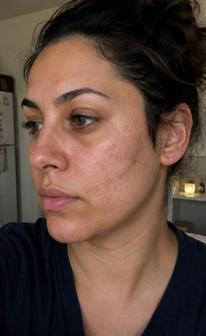 לפני